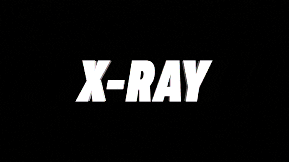 XRay